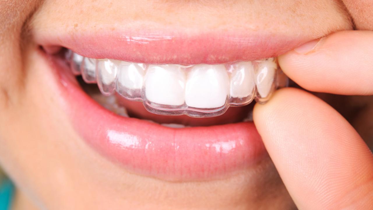 Les avantages pour la santé de faire redresser ses dents post thumbnail image
