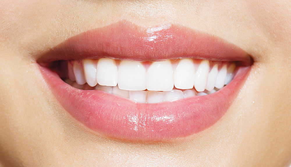 Pourquoi le blanchiment des dents ne doit être effectué que chez le dentiste post thumbnail image