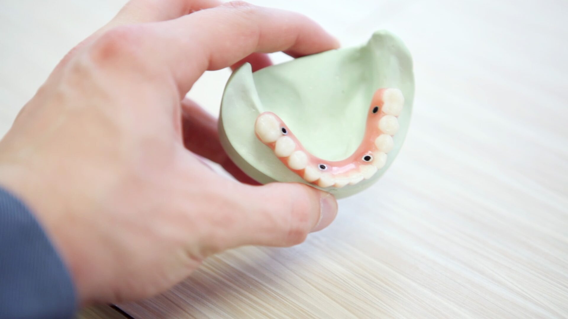 Implants Dentaires Modernes