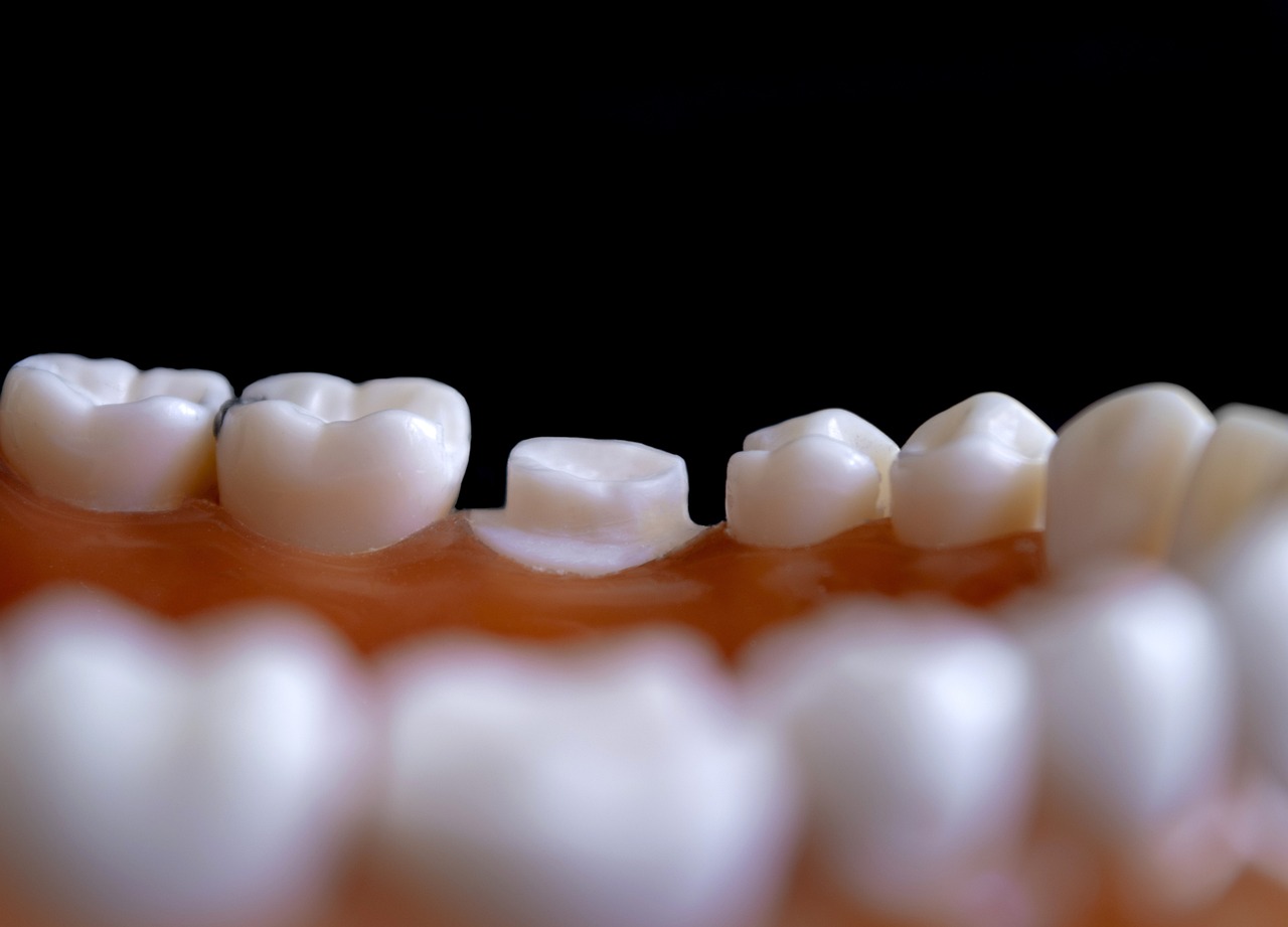 traitement orthodontique